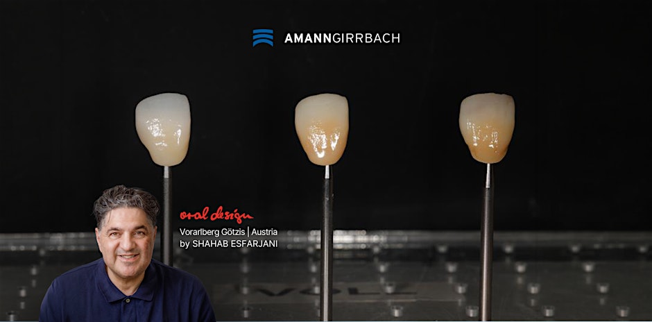Esthetic Management – „Kunst der Zeit - Charakterisierung von Zirkonoxid"